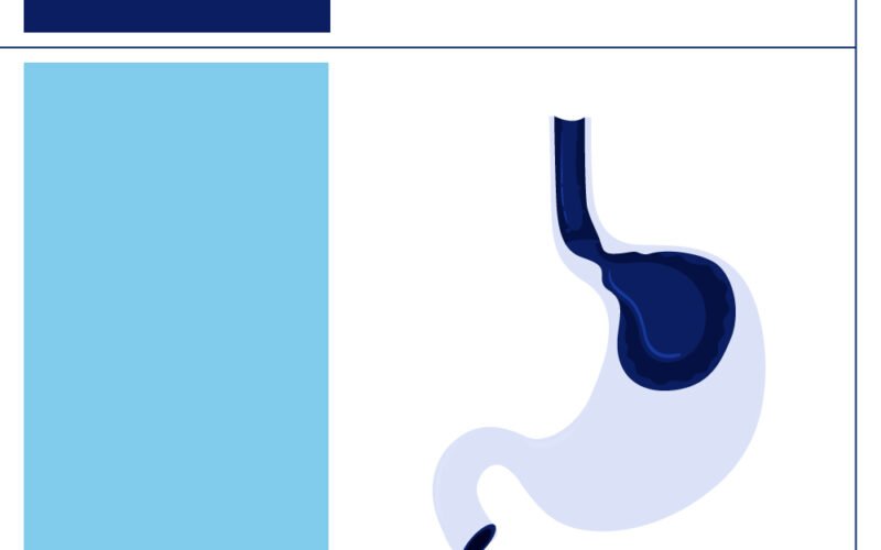 Gastroesophageal Reflux Disease (GERD) in Adolescents and Its Link to Modern Lifestyles 